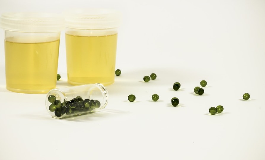 Facts To Know About Urine Drug Tests