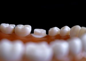 teeth